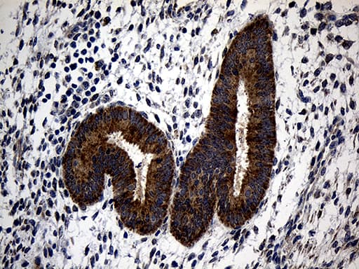 Monoclonal Mouse anti-Human ALDH7A1 Antibody (clone OTI10A12, IHC, WB)