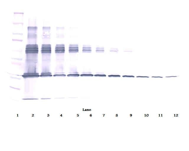 Polyclonal Rabbit anti-Human CSF1 / MCSF Antibody (WB)