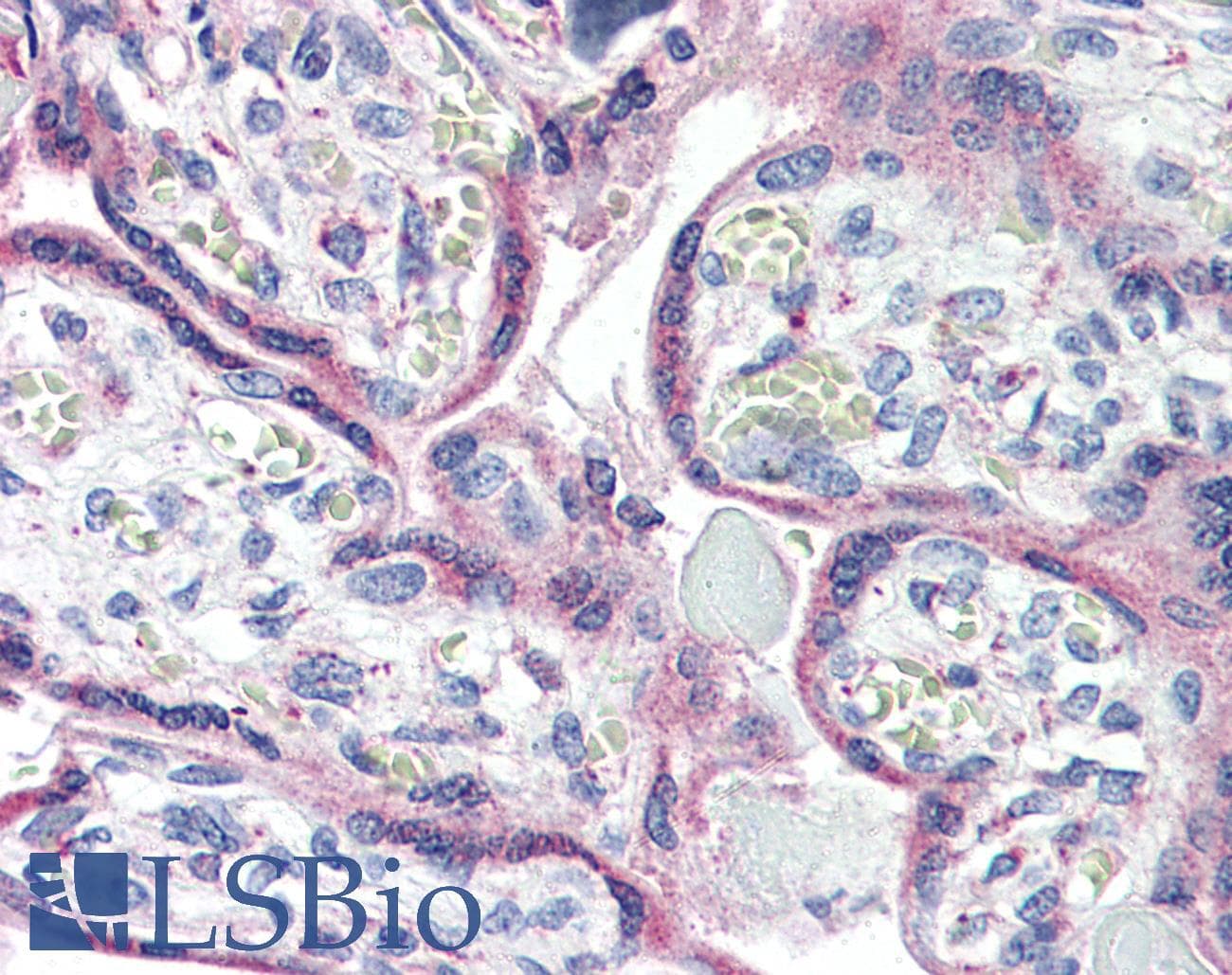 IHC-plus™ Polyclonal Rabbit anti-Human CXCR1 Antibody (Internal, IHC)