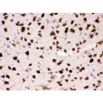 ELAVL4 / HuD Antibody (aa8-45)