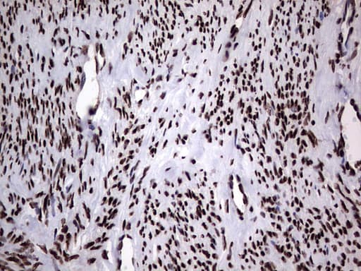 HNRNPL / hnRNP L Antibody (aa270-502, clone OTI2E4)