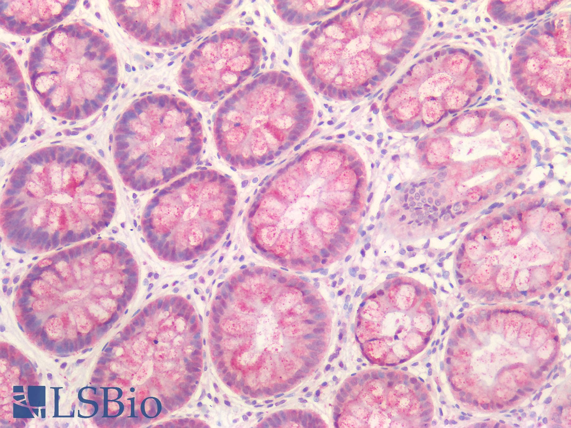 IHC-plus™ Polyclonal Rabbit anti-Human IL23A / IL-23 p19 Antibody (IHC)
