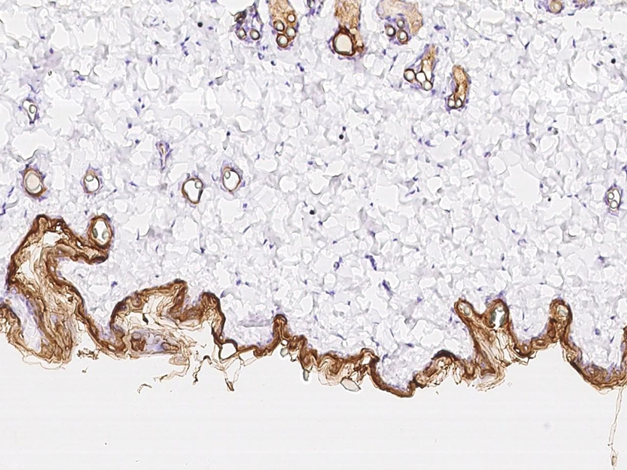 KRT10 / CK10 / Cytokeratin 10 Antibody