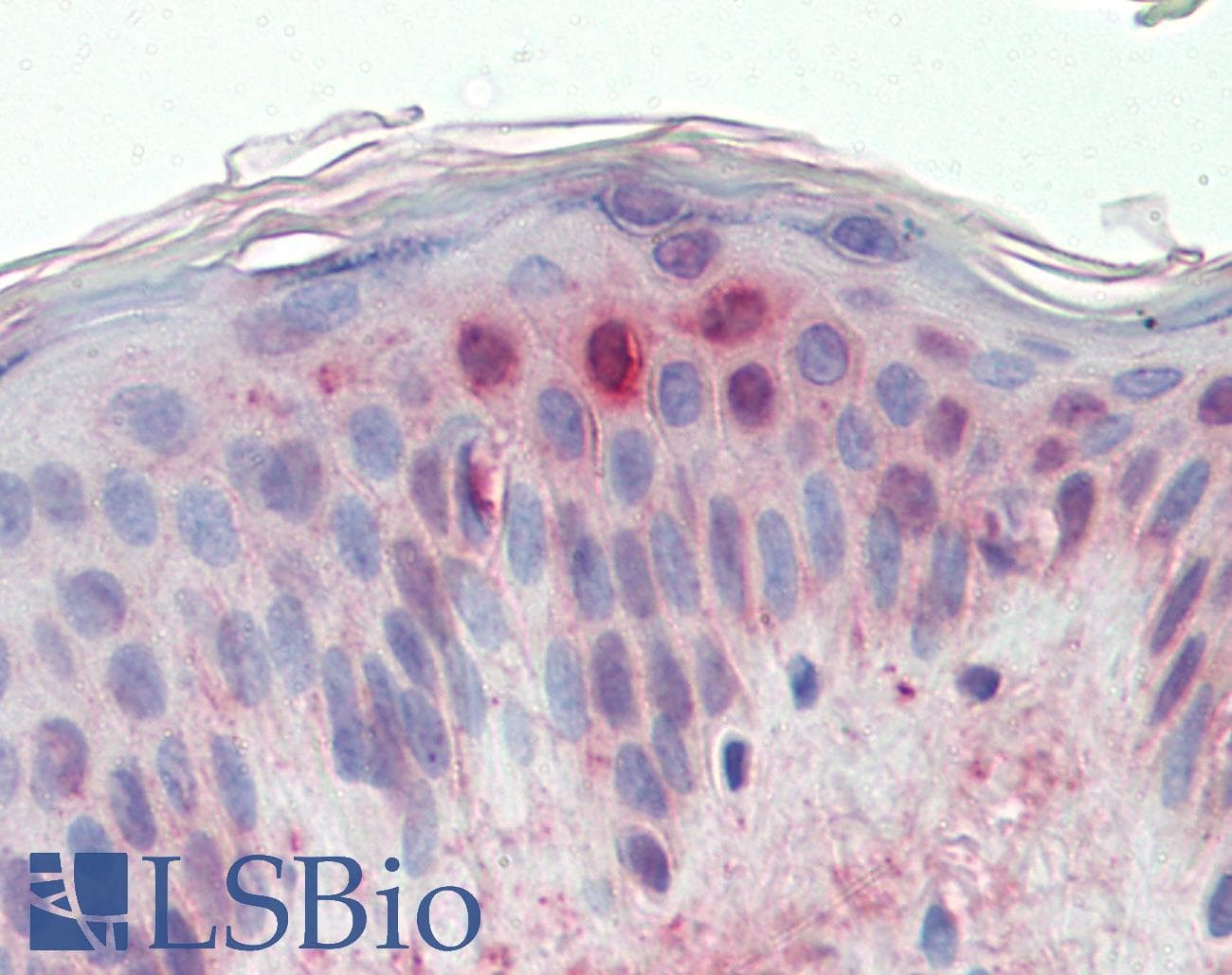 IHC-plus™ ZAK / MLTK Antibody