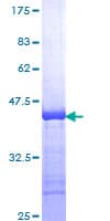 Human FXN / Frataxin Protein (Recombinant GST, N-terminus)