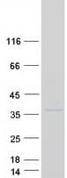 Human EMC2 / TTC35 Protein (Recombinant Myc-DDK (Flag))