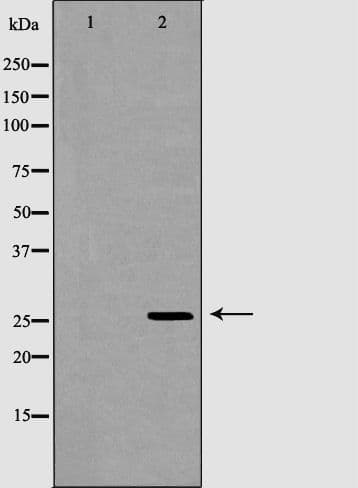 GSTM2 Antibody