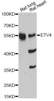 Polyclonal Rabbit anti-Human PEA3 / ETV4 Antibody (WB)