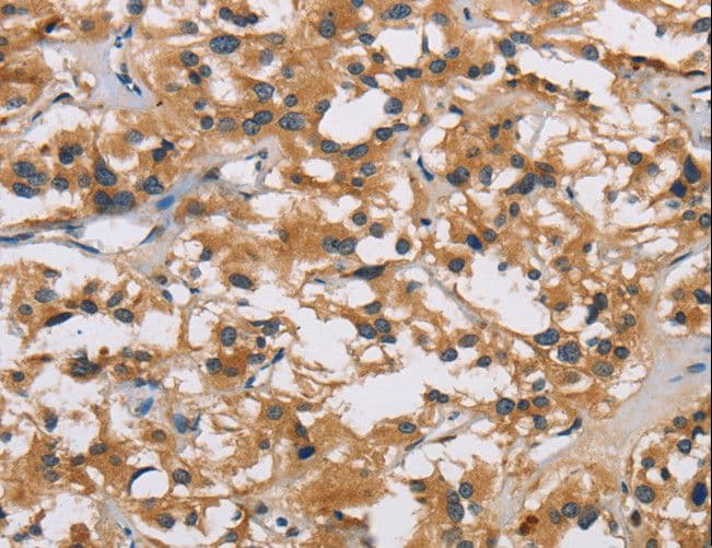 IHC-plus™ Polyclonal Rabbit anti-Human IL19 Antibody (aa39-52, IHC, WB)