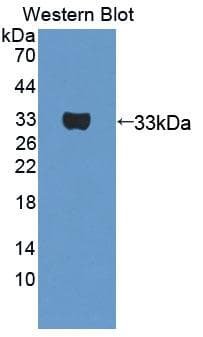 PTGFRN Antibody (aa406-662)
