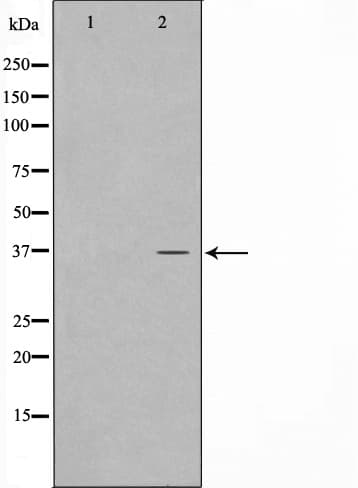 Polyclonal Rabbit anti-Human CARP / ANKRD1 Antibody (IF, WB)
