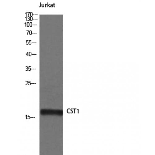 CST1 / Cystatin SN Antibody (1-80 aa, Internal)