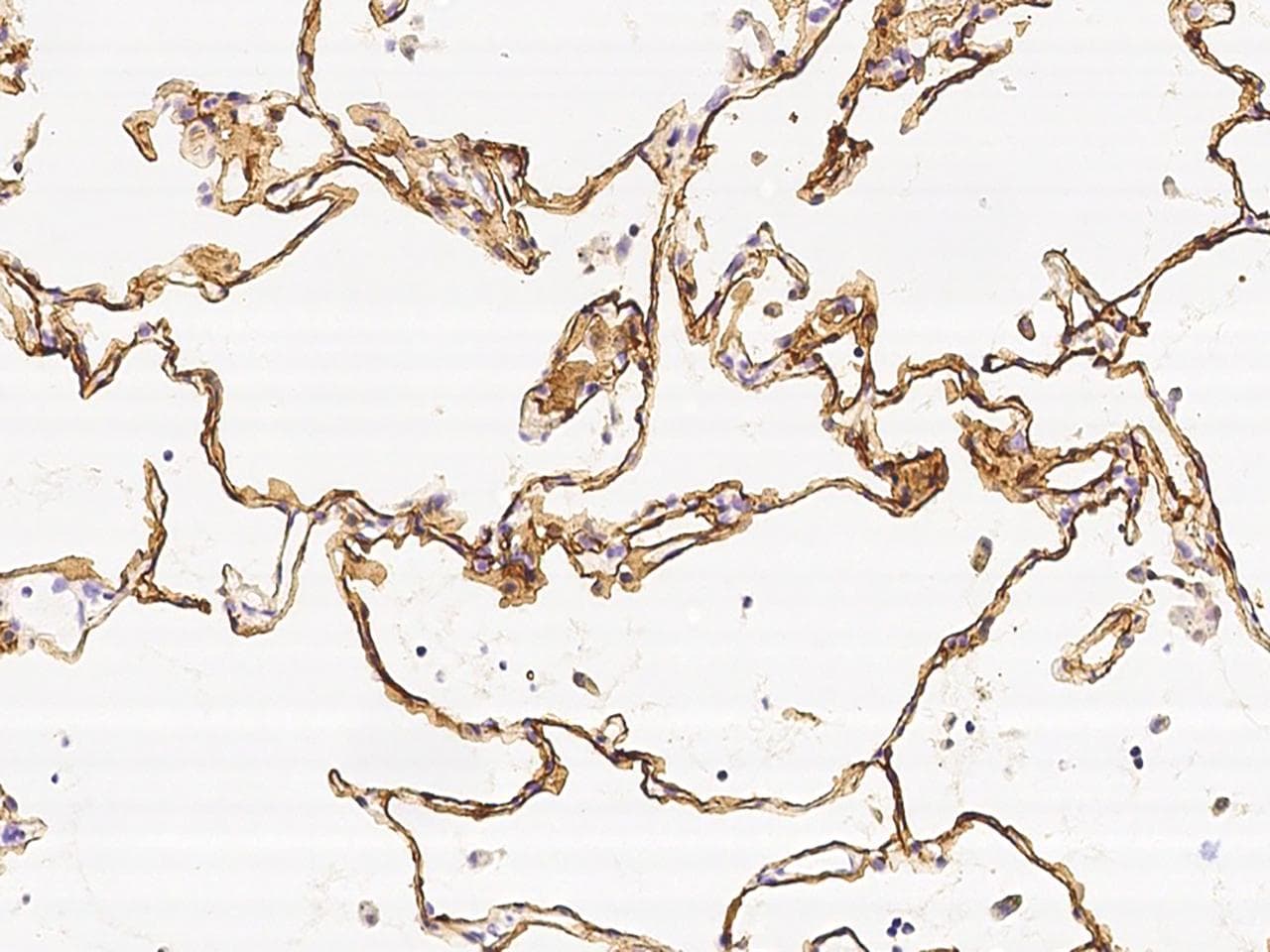 AGER / RAGE Antibody (Preservative Free)