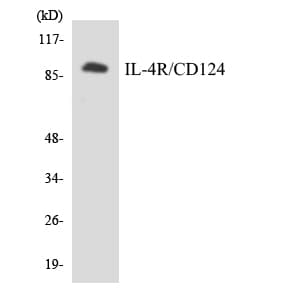 IL4R / CD124 Antibody (aa444-493)