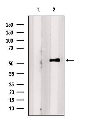 Polyclonal Rabbit anti-Human SAMSN1 Antibody (WB)