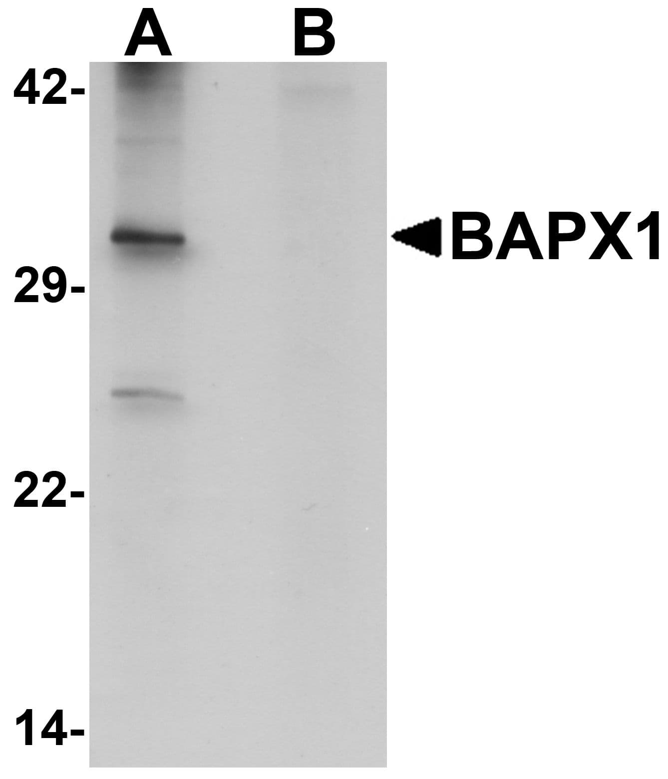 IHC-plus™ NKX3-2 / BAPX1 Antibody