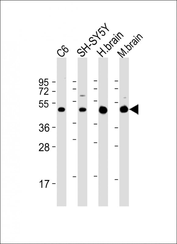 SLC2A3 / GLUT3 Antibody (C-Terminus)