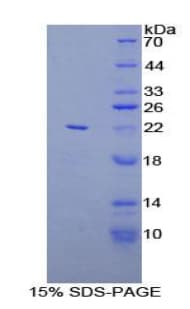 Rat LAT2 / NTAL Protein (Recombinant His-T7)