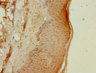 Polyclonal Rabbit anti-Human PSMB3 Antibody (IHC, WB)