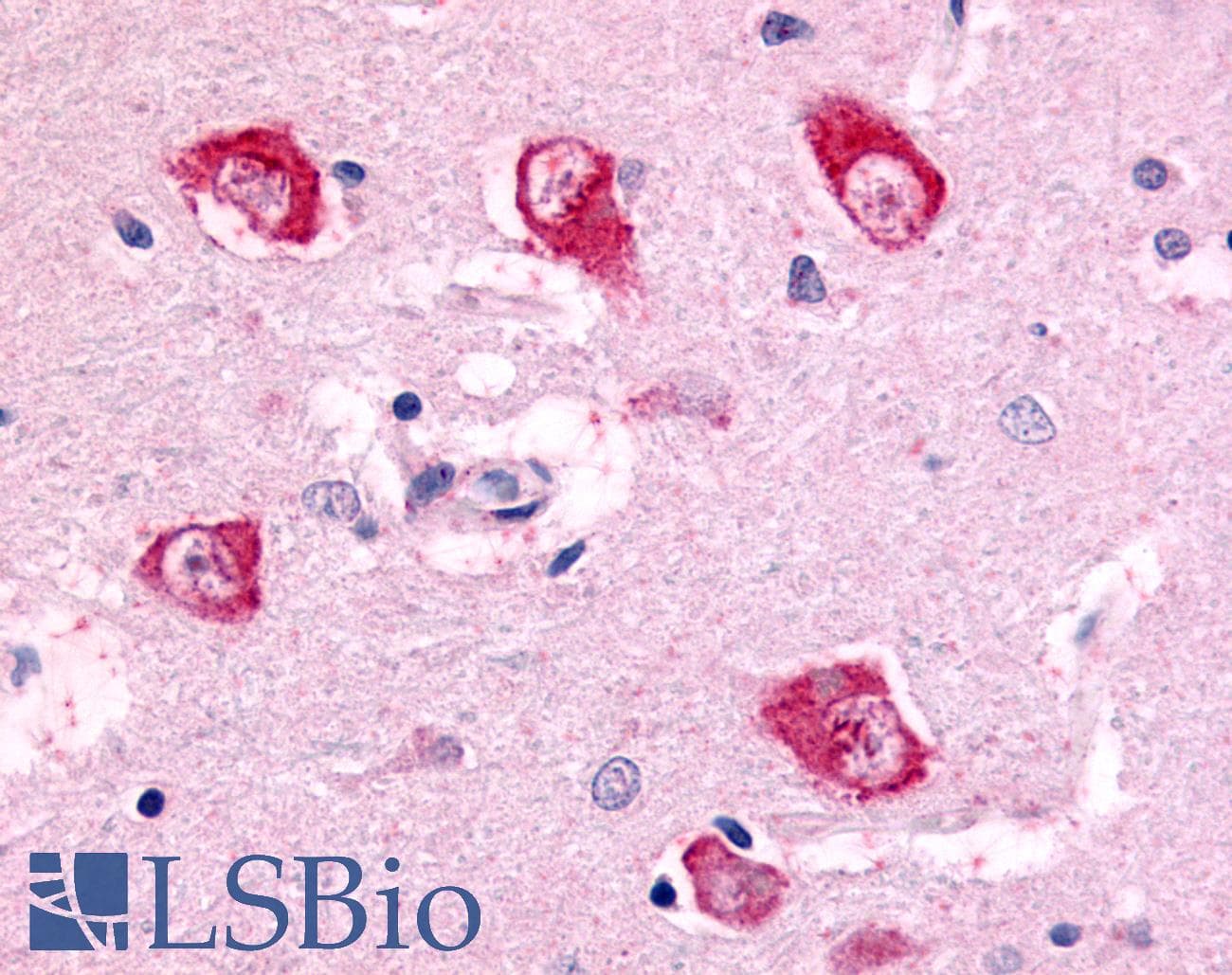 PathPlus™ PAK7/PAK5 Antibody (Internal)