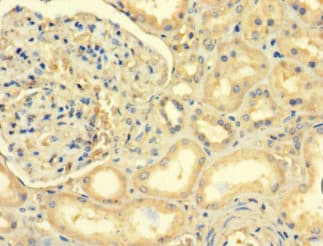 ABLIM2 Antibody