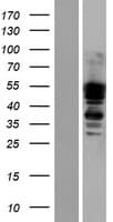 DTNA / Dystrobrevin Alpha Protein (Over-Expression Lysate Myc-DDK (Flag))