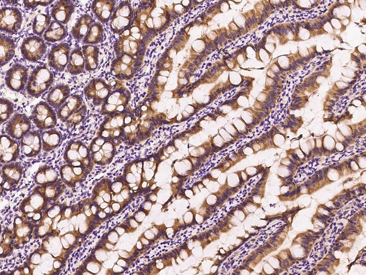 RAB1A Antibody (Preservative Free)