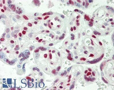 IHC-plus™ Polyclonal Rabbit anti-Human USP7 / HAUSP Antibody (aa1-50, IHC, IF)