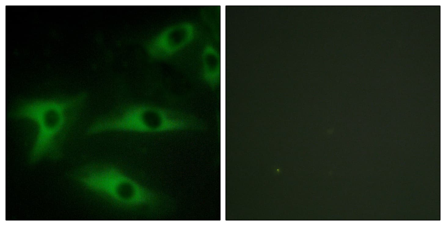 IHC-plus™ COL1A2 / Collagen I Alpha 2 Antibody (aa471-520)