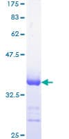 Human CKS1B / CKS1 Protein (Recombinant GST, N-terminus)