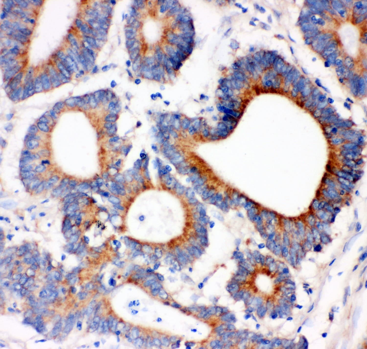 IRS1 Antibody (aa1041-1242)