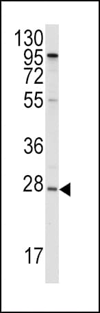 Polyclonal Rabbit anti-Human APOA1 / Apolipoprotein A 1 Antibody (aa10-37, IHC, WB)