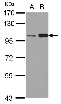 Polyclonal Rabbit anti-Human KIF3C Antibody (WB)
