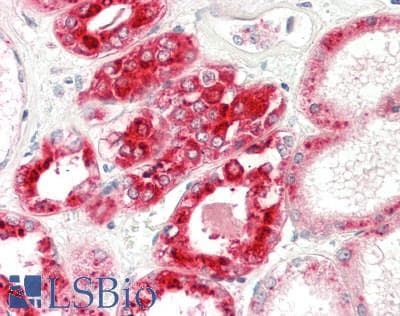IHC-plus™ Monoclonal Mouse anti-Human REN / Renin 1 Antibody (clone 4A3, aa131-406, IHC, WB)