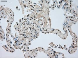 Monoclonal Mouse anti-Human NTRK3 / TRKC Antibody (clone OTI4E10, IHC, IF, WB)