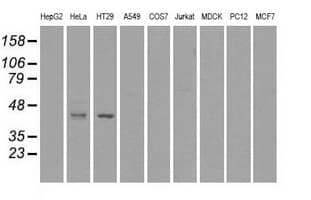 GLUL / Glutamine Synthetase Antibody (clone OTI1F4)