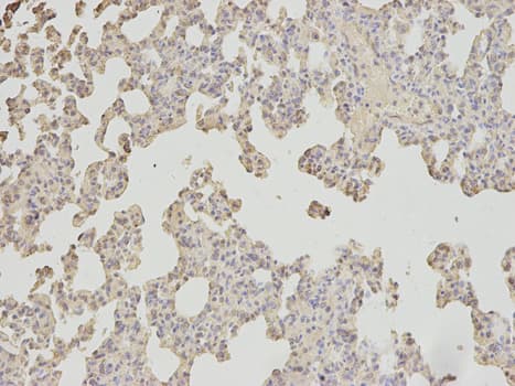 APOM / Apolipoprotein M Antibody