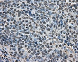 ARNT / HIF-1-Beta Antibody (clone OTI1D10)