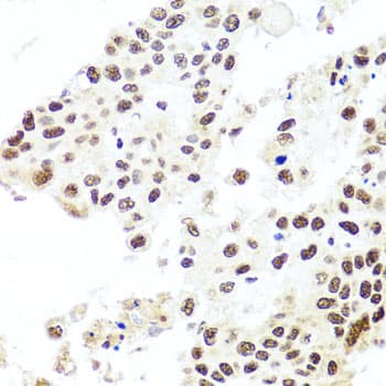 Polyclonal Rabbit anti-Human HIRA Antibody (IHC, WB)