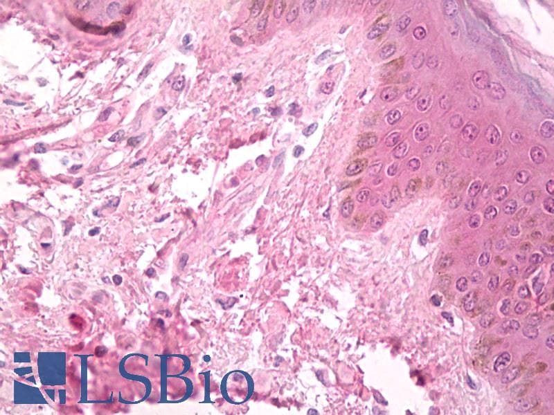 IHC-plus™ LOX / Lysyl Oxidase Antibody (aa118-168)