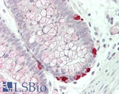 IHC-plus™ PD2 / PAF1 Antibody (aa75-125)