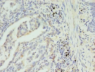 SLC35F5 Antibody