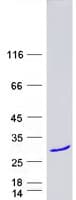 Human LIN7B Protein (Recombinant Myc-DDK (Flag))