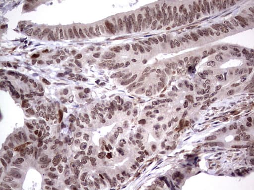 MDM2 Antibody (aa119-438, clone OTI22D6, Carrier-free)