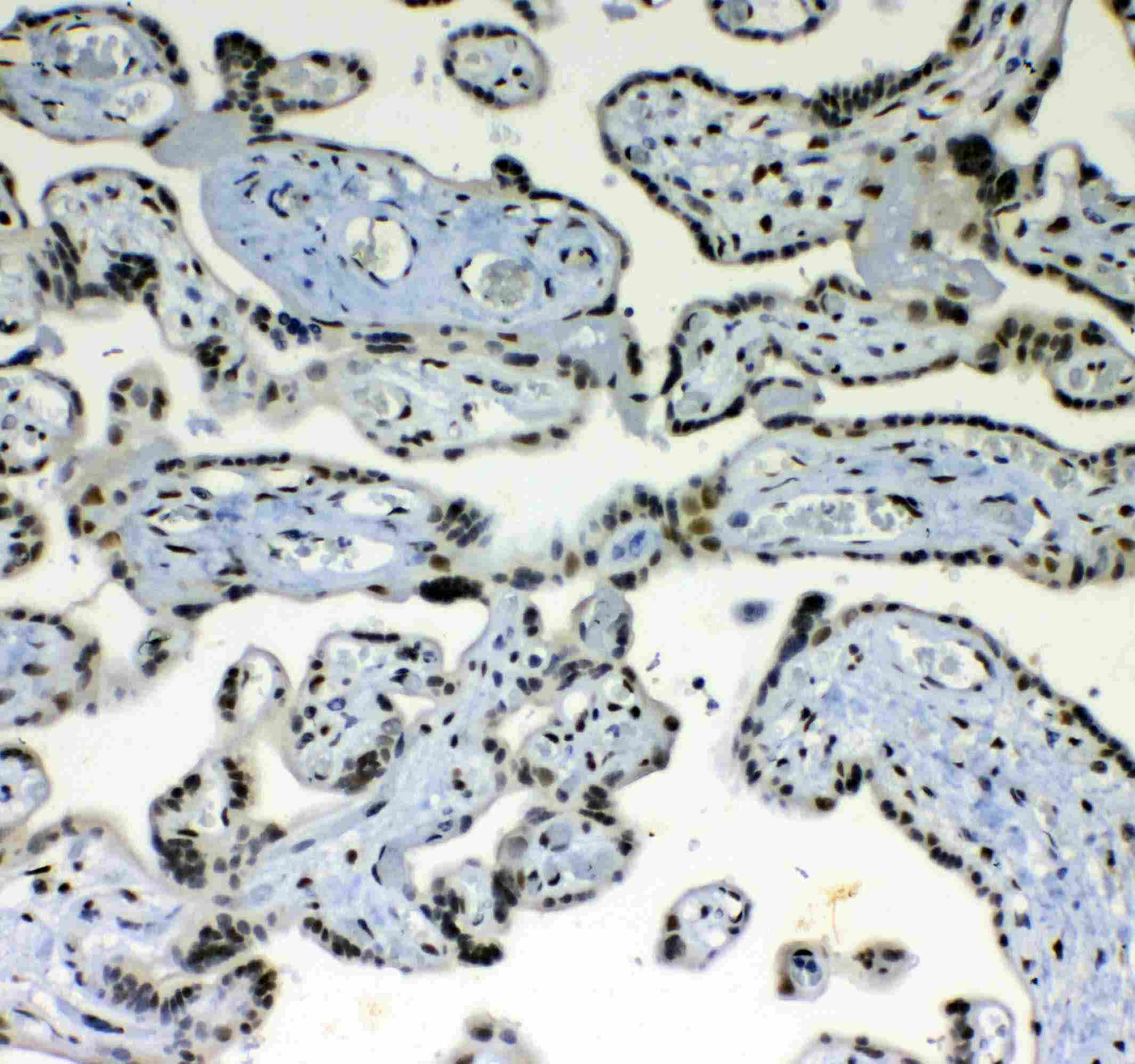 BLIMP1 / PRDM1 Antibody