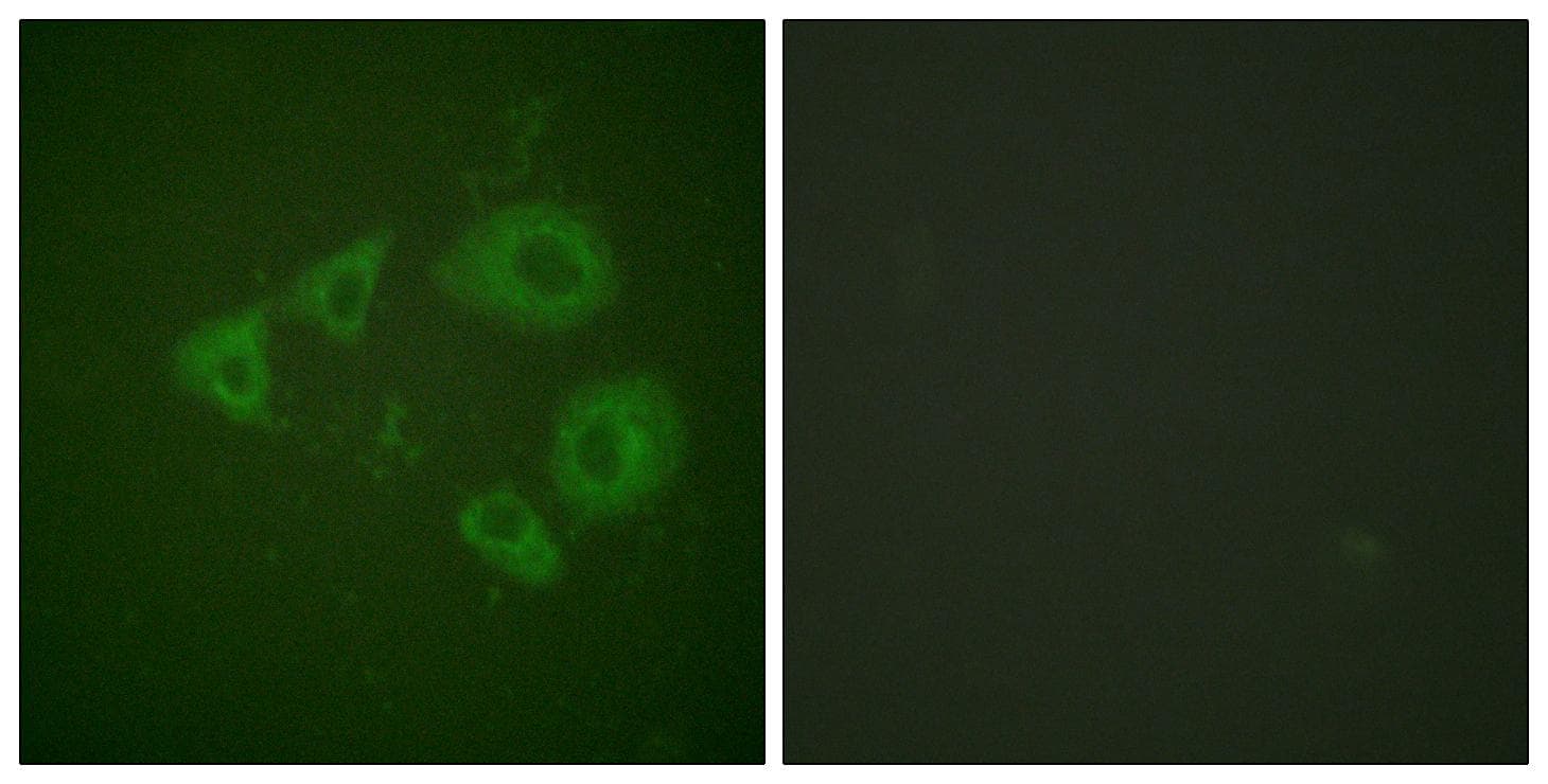 NTRK2 / TRKB Antibody (phospho-Tyr705)