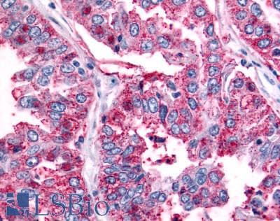 PathPlus™ Polyclonal Rabbit anti-Human ADGRB2 / BAI2 Antibody (C-Terminus, IHC)