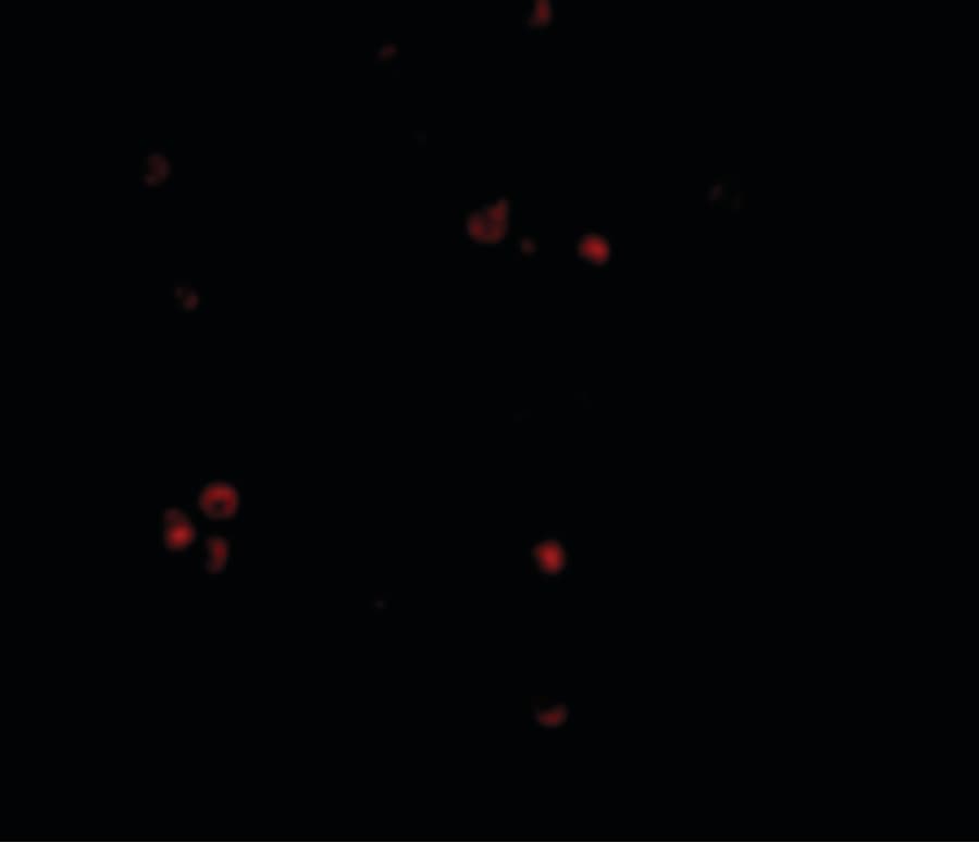 IHC-plus™ IFIH1 / MDA5 Antibody
