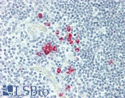 IHC-plus™ AXIN2 / Axin 2 Antibody (Internal)