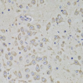Polyclonal Rabbit anti-Human RPL3 / Ribosomal Protein L3 Antibody (IHC, WB)